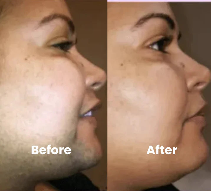 Before and after Hydrateology results