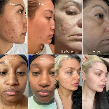 NIDA Youthful Moisturizer